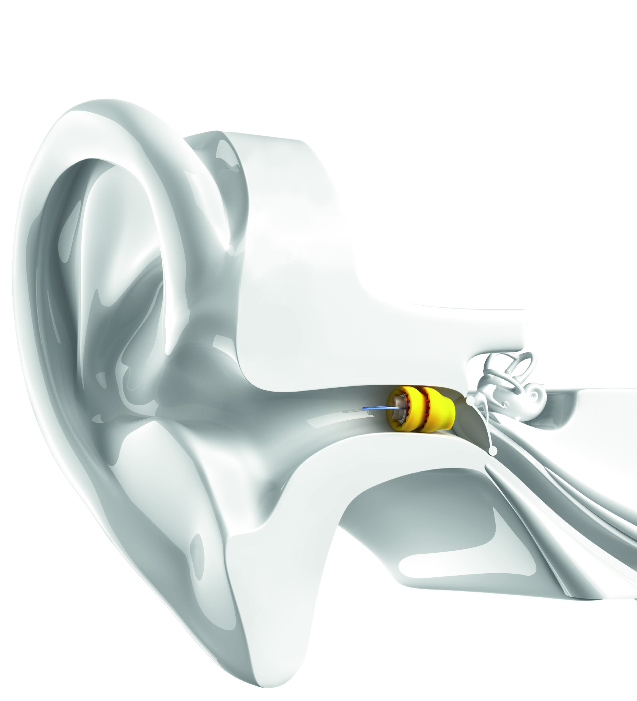 phonak_lyric_official_anatomic_fit_view.png